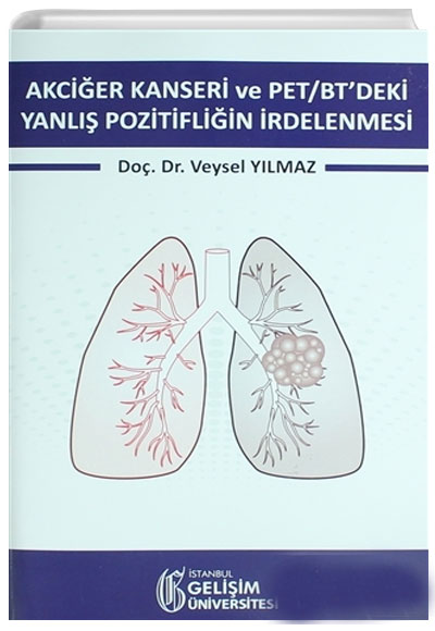 Akci�er Kanseri ve PET/BT deki Yanl�� Pozitifli�in �rdelenmesi Veysel Y�lmaz  �stanbul Geli�im �niversitesi Yay�nlar�