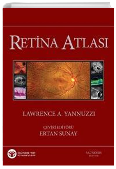 Yannuzzi Retina Atlas� 2013 - Ertan Sunay G�ne� T�p Kitabevi